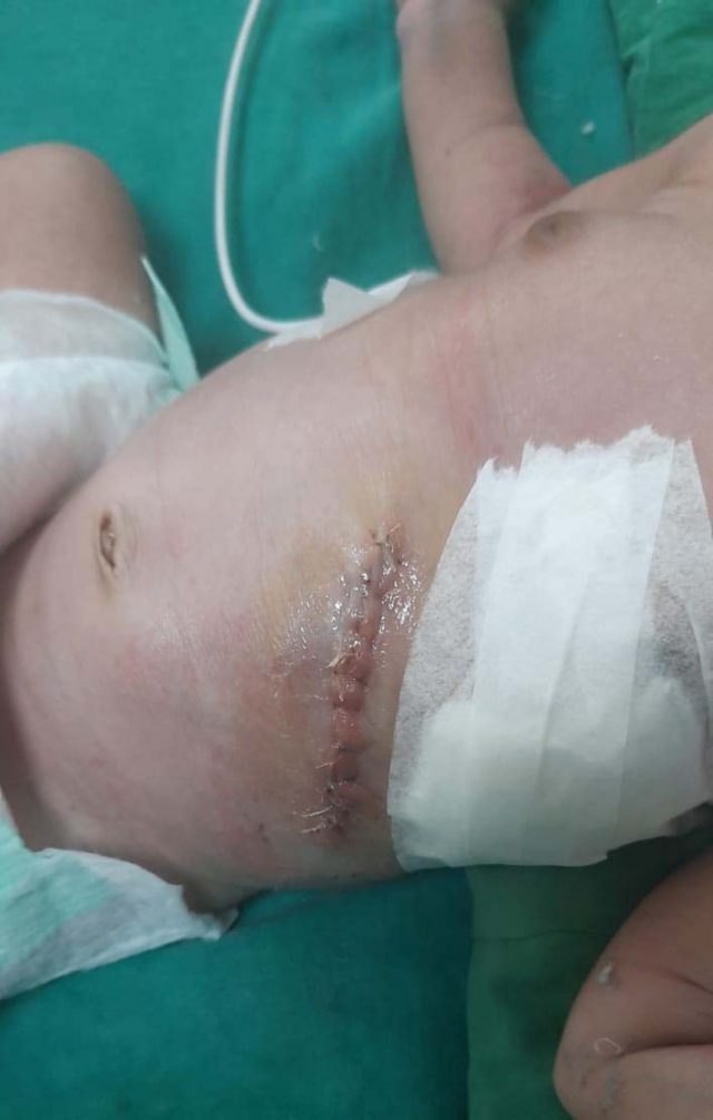 ସମରେ ବିରଳ ଅସ୍ତ୍ରୋପଚାର