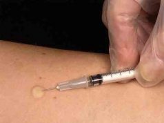 କୋଭିଡ ରୋଗୀଙ୍କର ହେବ ଯକ୍ଷ୍ମା ପରୀକ୍ଷା