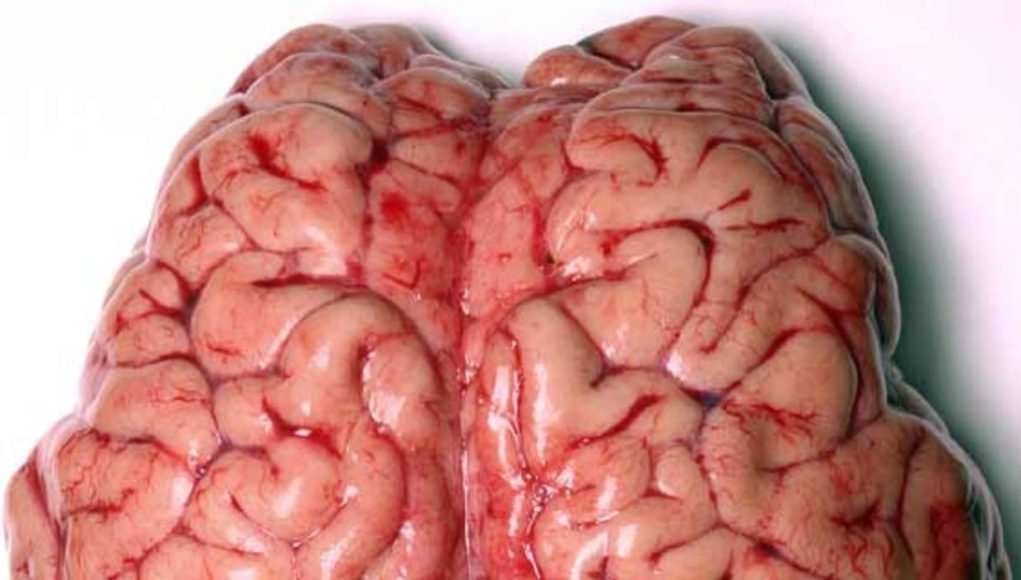 SWADESH For Brain Care