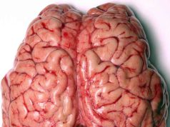 SWADESH For Brain Care