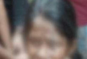 Balanga Burn Victim Dies